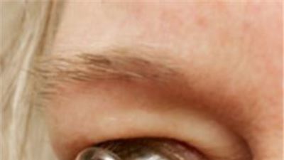 Contact lens which releases drugs into the eye gives new hope to glaucoma sufferers