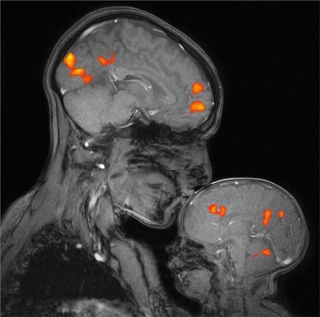 This is the first MRI capturing the brain activity of a mother kissing her child...